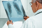Diagnose Lungenkrebs